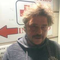 Fisciano (Sa): agenti di polizia picchiano violentemente Tony Della Pia candidato di Potere al Popolo