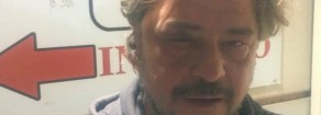 Fisciano (Sa): agenti di polizia picchiano violentemente Tony Della Pia candidato di Potere al Popolo