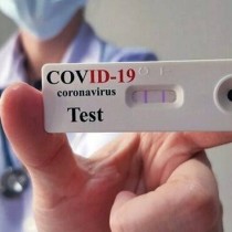 COVID. Test salivari, diagnosi precoce, terapia domiciliare