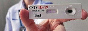 COVID. Test salivari, diagnosi precoce, terapia domiciliare